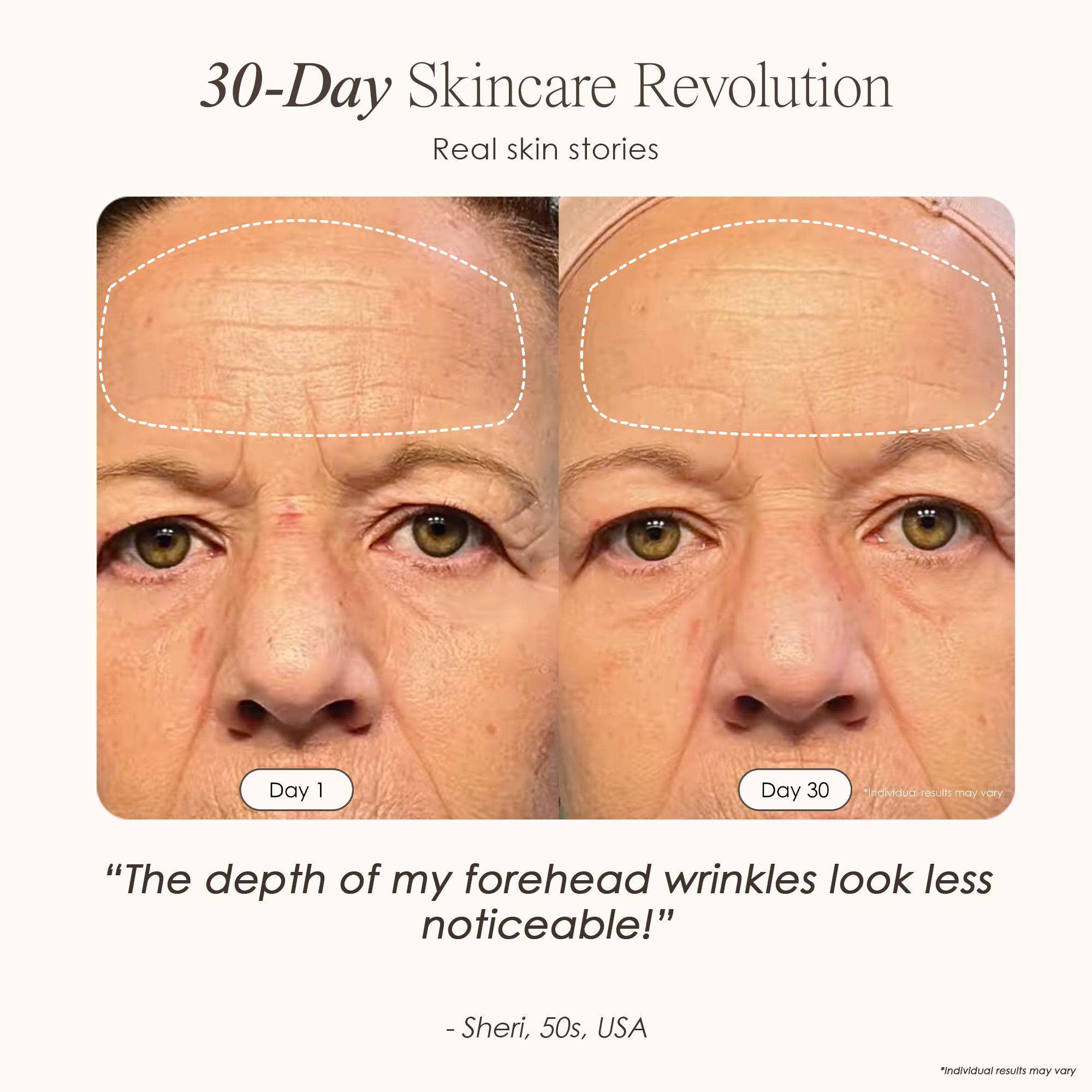 visible results after 30 days of using the LED light therapy mask